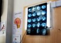 “11 anni di chemio per un tumore che non c’era”, la diagnosi sbagliata e l’incubo