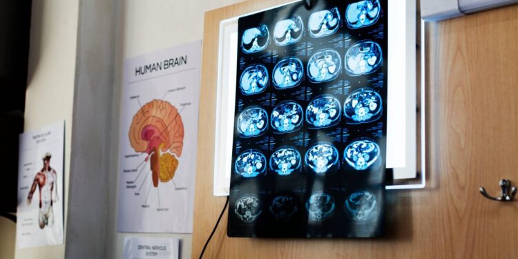 “11 anni di chemio per un tumore che non c’era”, la diagnosi sbagliata e l’incubo