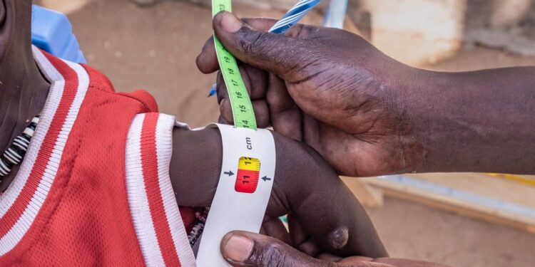 Save the Children: 1 bambino su 4 sotto i 5 anni, nel mondo, soffre di grave povertà alimentare